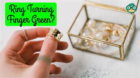 ring turns your finger green.